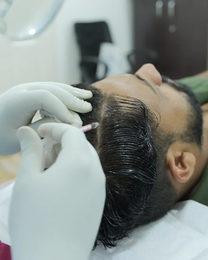 Dermatologist at DermaVue Gandhipuram clinic performing PRP hair treatment on a patient in Coimbatore
