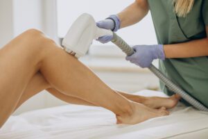 Laser Hair Removal Method
