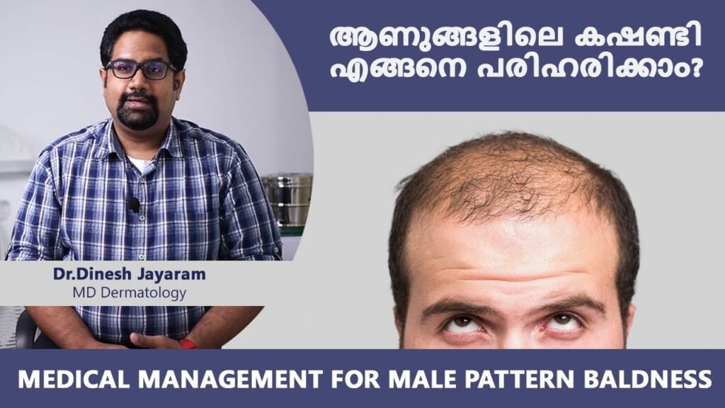 Hair transplantation Cochin Kerala Hair loss treatment FUT FUE