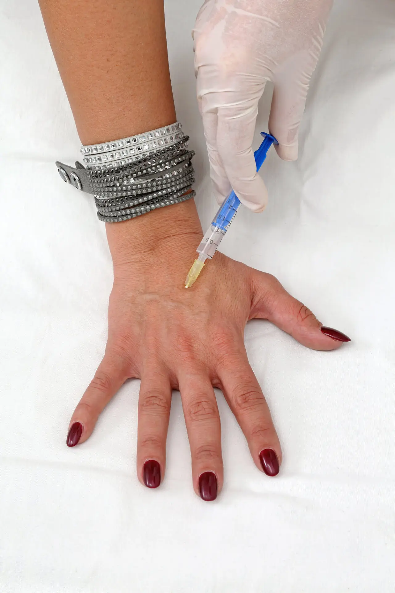 Advanced Hand Rejuvenation at DermaVue: Restore Youthful Elegance