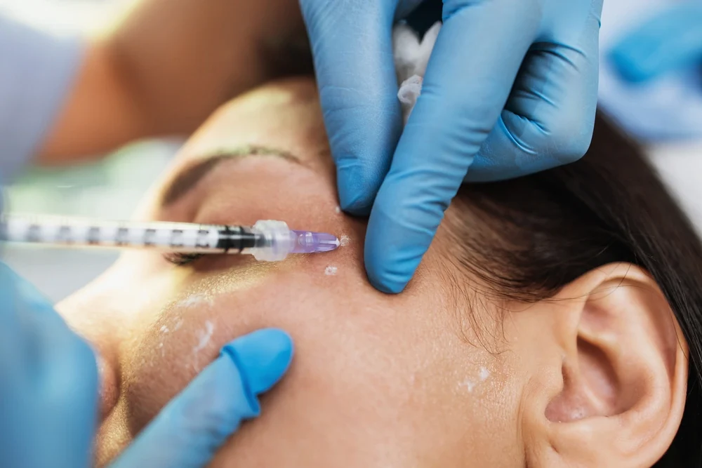 Expert Botox Treatments at DermaVue - Discover the Artistry of Ageless Beauty