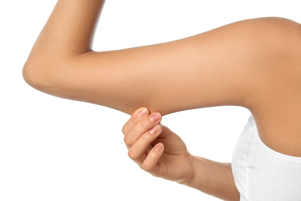 Woman showcasing toned arms after transformative arm fat treatment