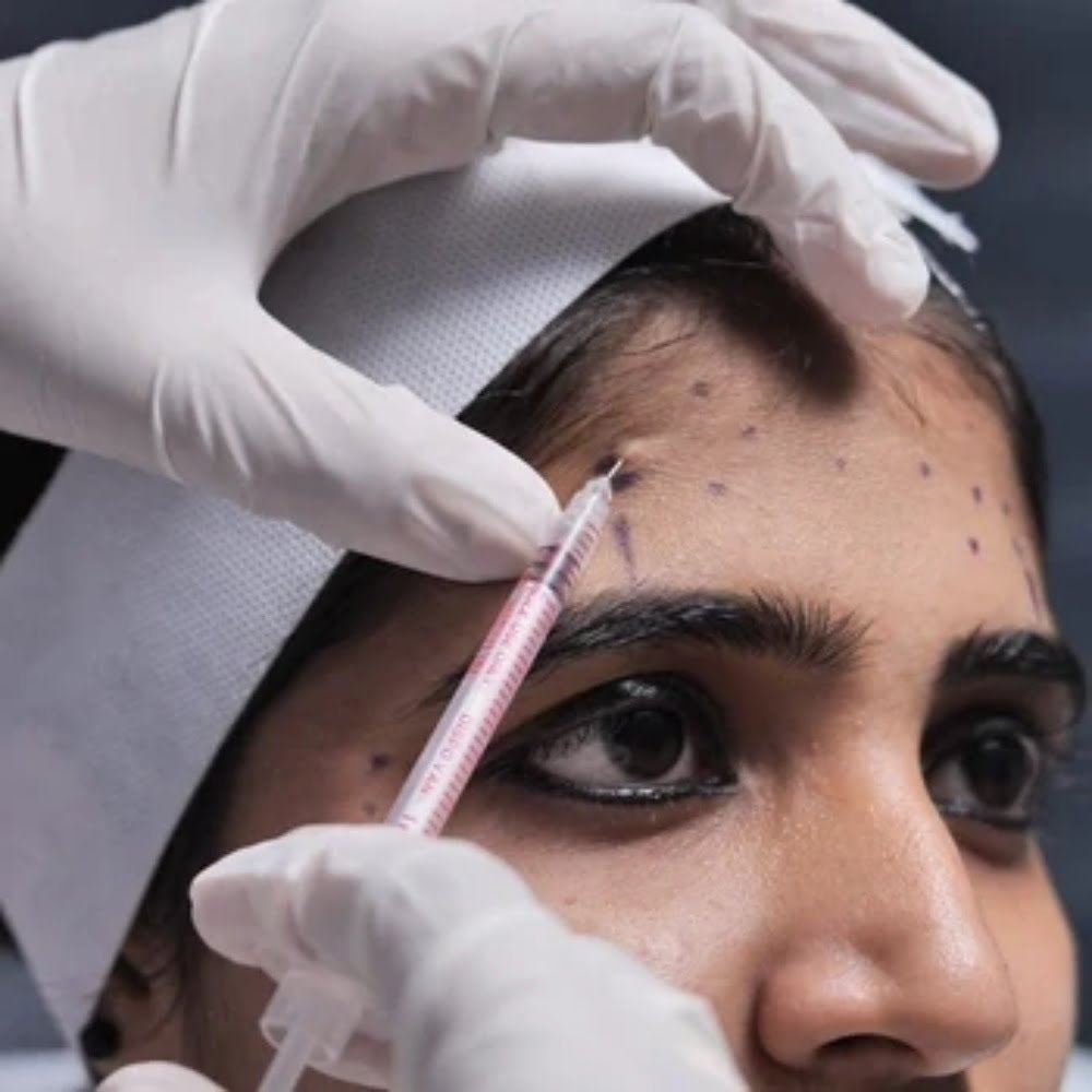 Botox Treatment — DermaVue Thiruvalla