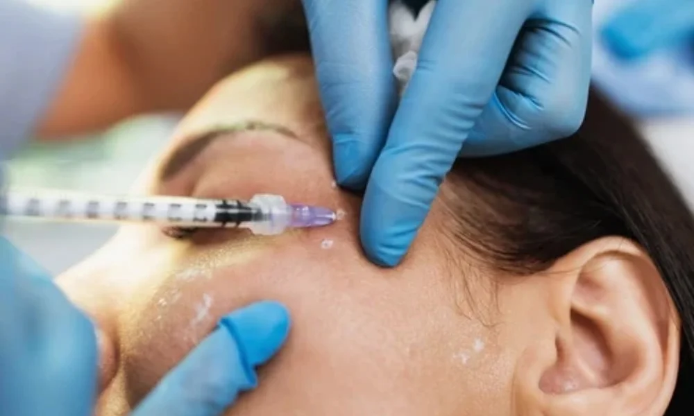 Dermal Fillers at DermaVue Thiruvalla