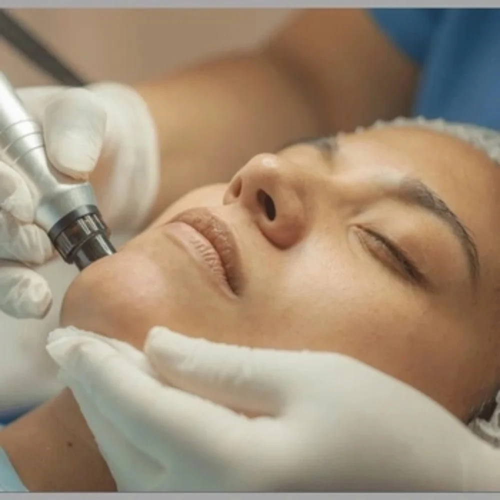 HydraFacial at DermaVue Thiruvalla