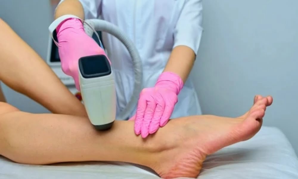 Laser Hair Removal — DermaVue Thiruvalla