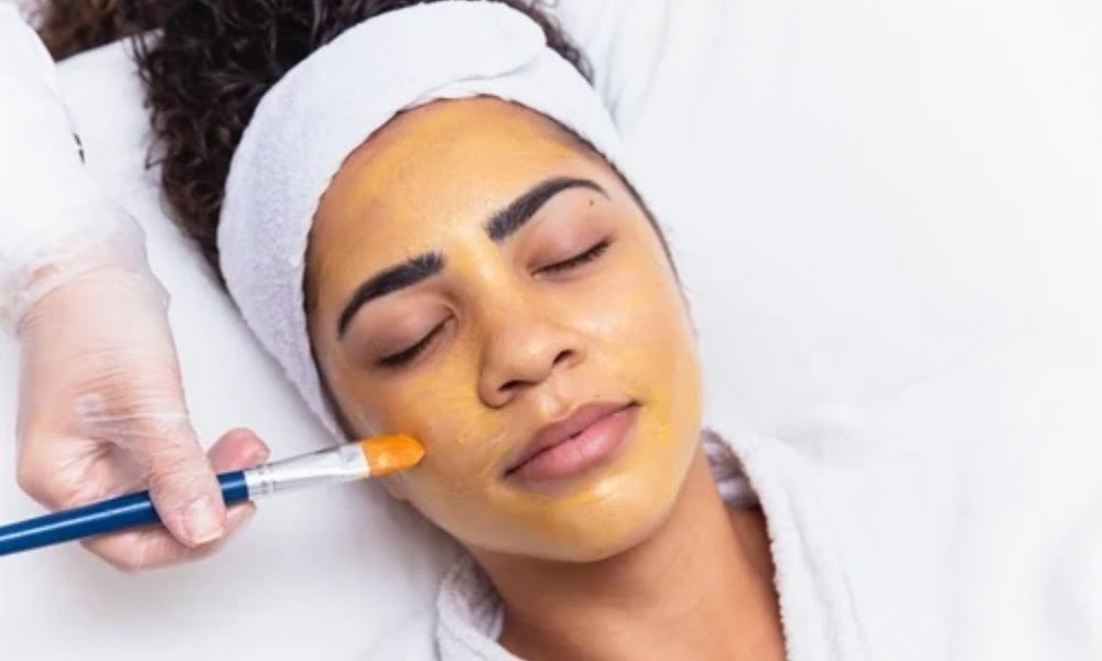 Chemical Peels — DermaVue Thiruvalla