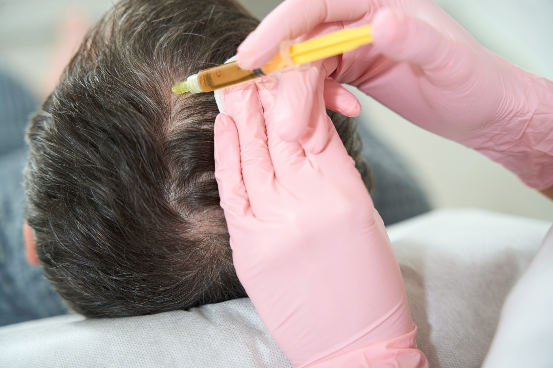 Specialist performs the plasmolifting procedure in the scalp