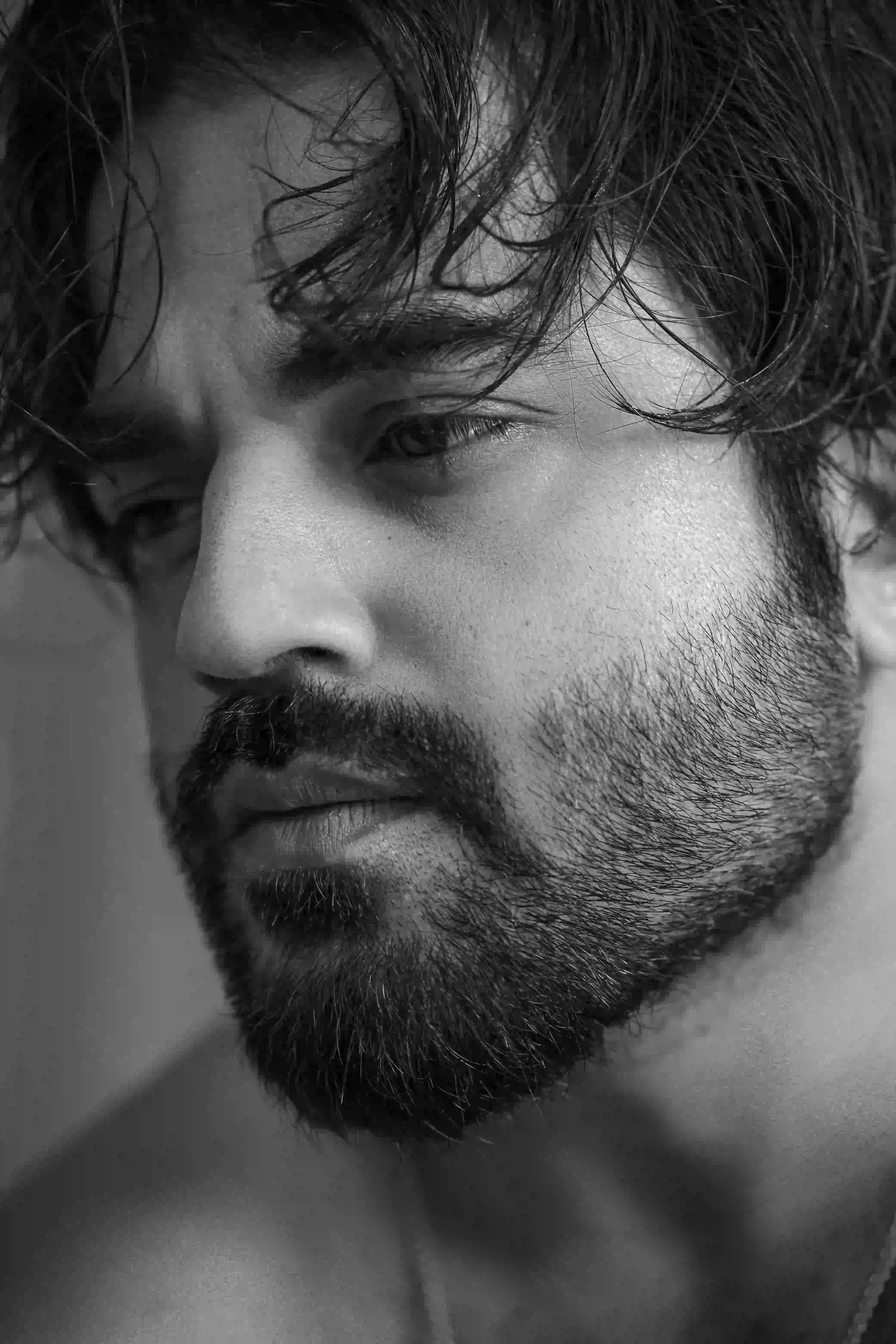 Beard & Mustache Transplant Coimbatore