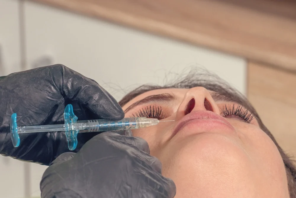 Dermal Fillers Coimbatore | Expert Dermatologists