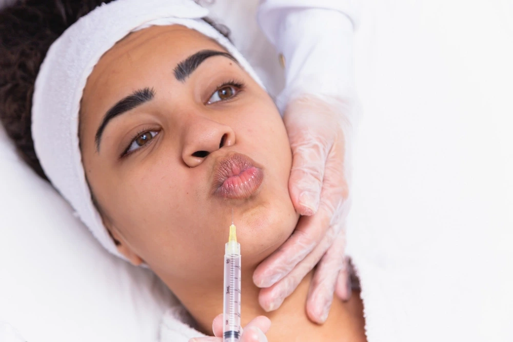 Dermal Fillers in Coimbatore | Cost, Lips & Cheeks