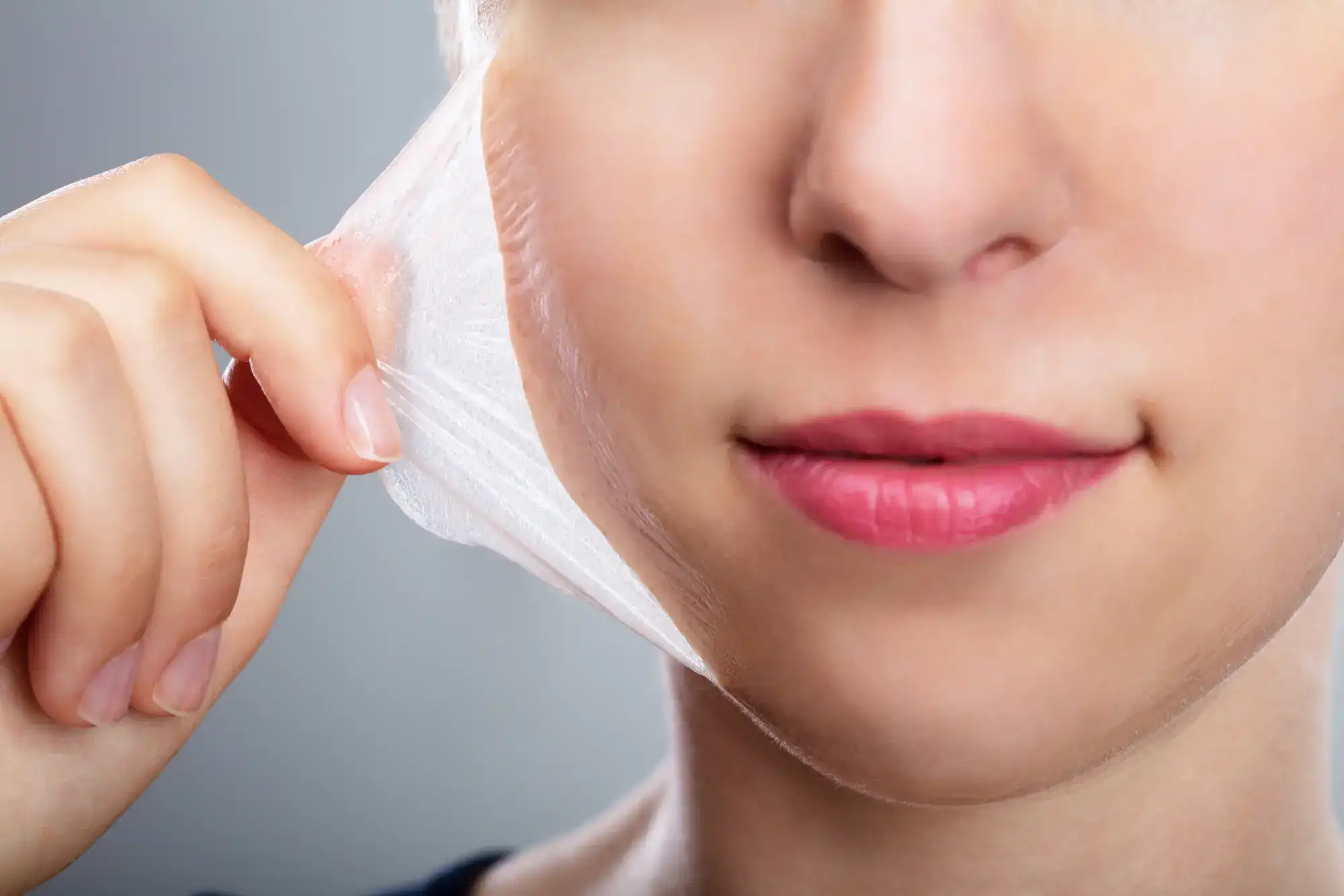 Skin Peels DermaVue