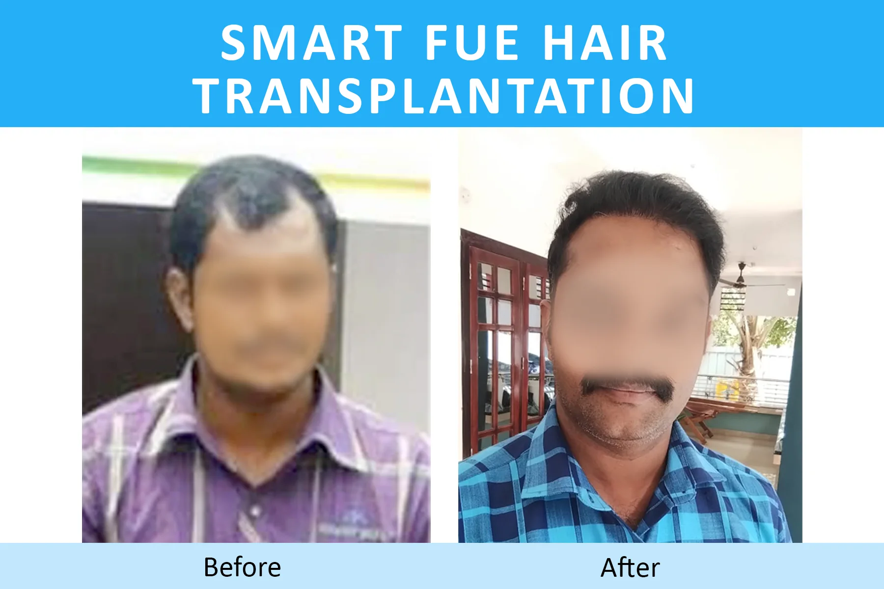 dermavue coimbatore clinic