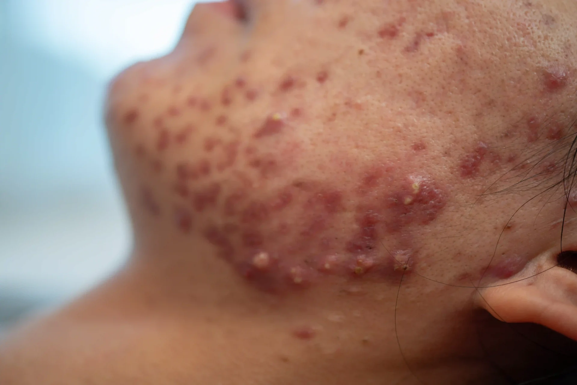 DERMATOLOGIST NEAR ME KOLLAM, KERLA _1