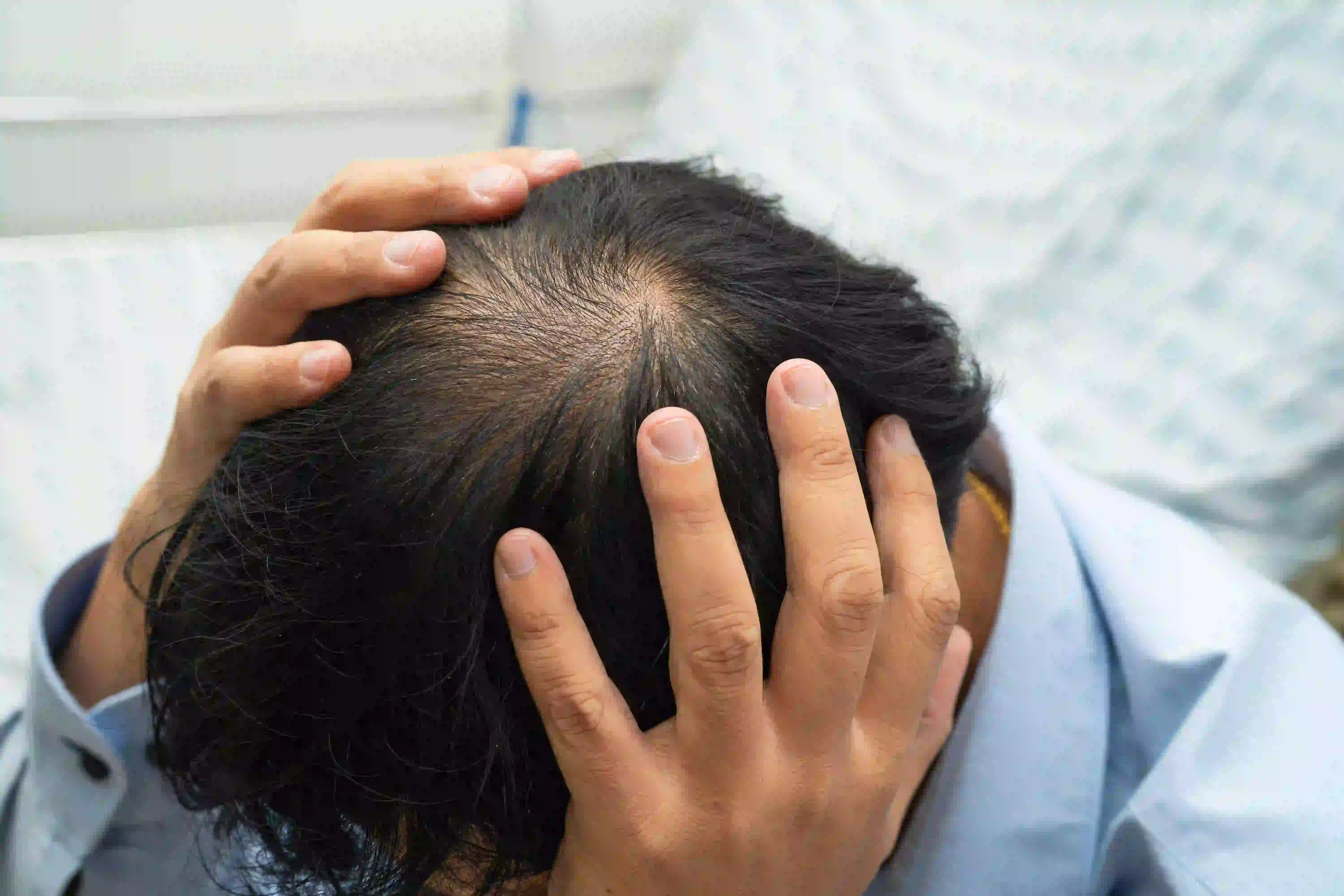 Dandruff Treatment in Coimbatore | Expert Scalp Care - DermaVue