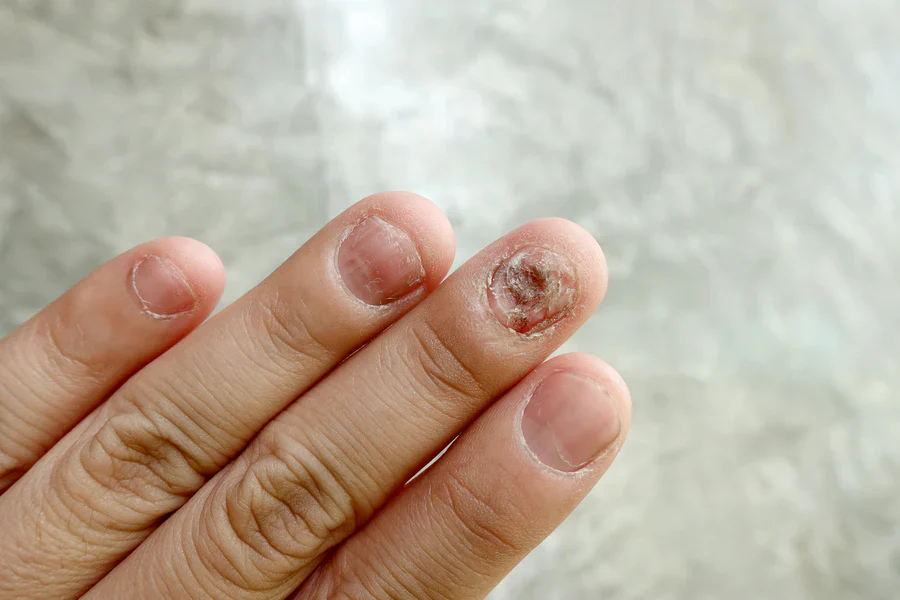 Dermatologist-Kochi-_140