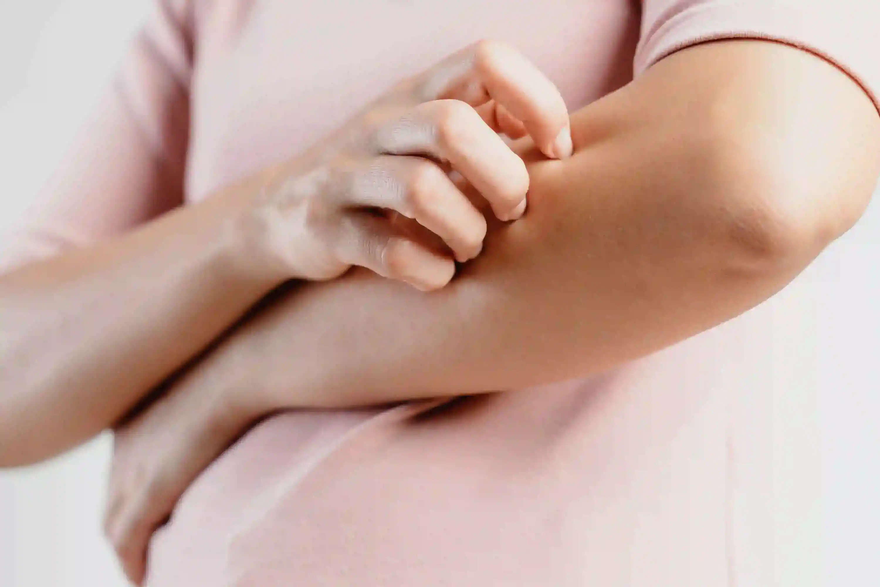 DERMATOLGIST-KOTTAYAM-DERMAVUE_25, Atopic Dermatitis