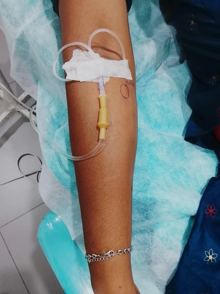 Glutathione Treatment, DERMATOLGIST-THIRUVANANTHAPURAM-DERMAVUE_75