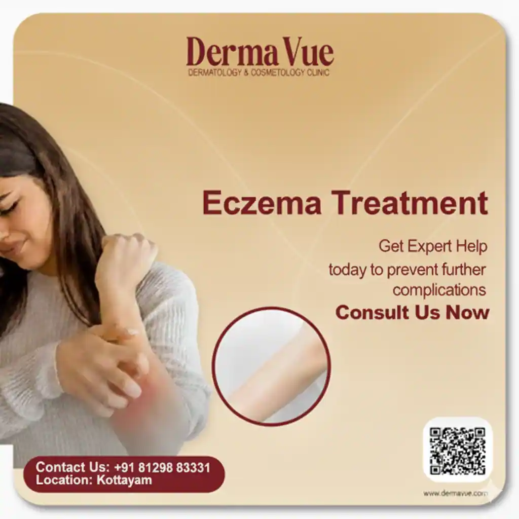 Eczema treatment at DermaVue Kottayam