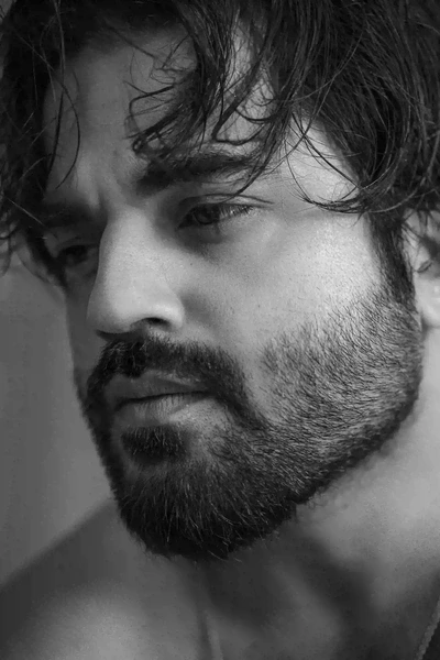 Dermatologist-Thiruvalla-skin-specialist_158, Beard Transplant