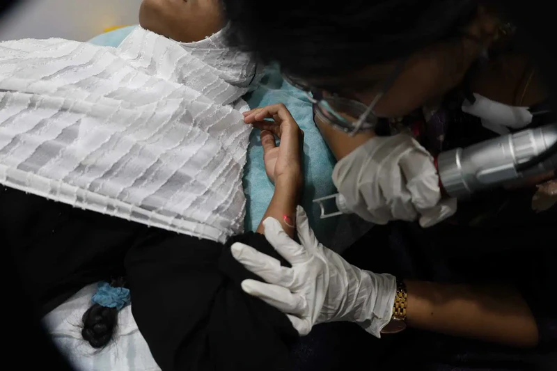 Dermatologist-Thiruvalla-skin-specialist_262, Wart Removal