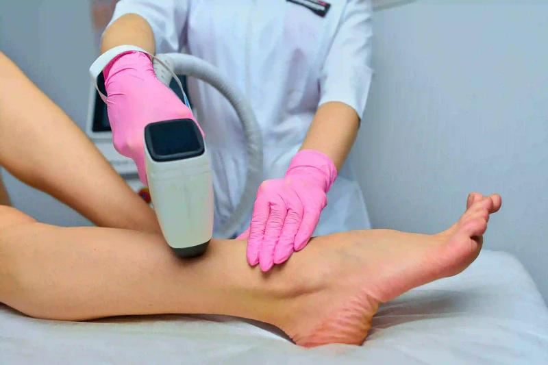 Dermatologist-Thiruvalla-skin-specialist_422, Laser Hair Removal