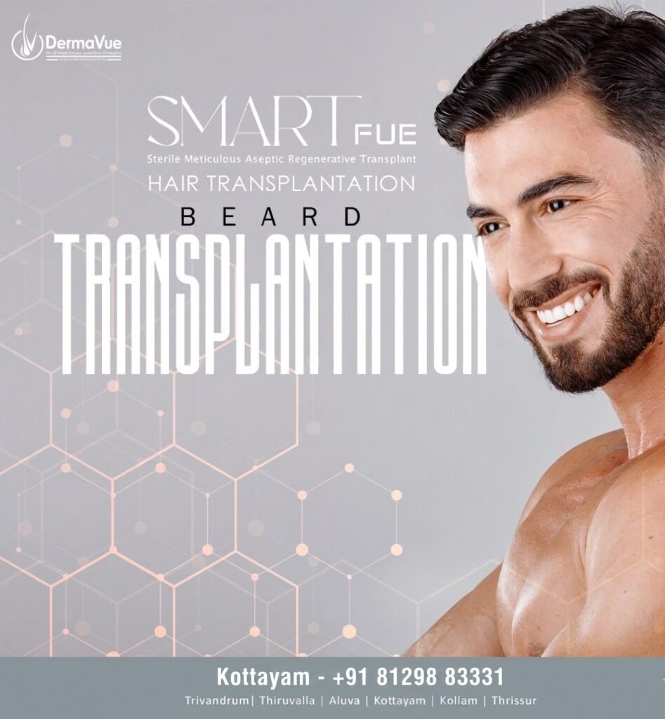 Beard transplant at DermaVue Kottayam