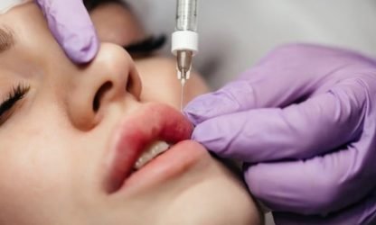Woman receiving lip volume enhancement treatment at skin care clinic - Kerala.