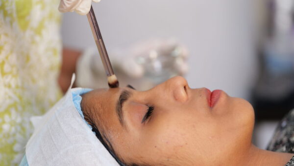 chemical-peel-treatment-dermavue-thrissur (1)