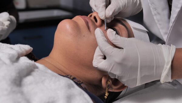 non-invasive-wart-mole-removal-kollam